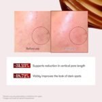 VT COSMETICS Red Booster Reedle Shot 100, Microneedling Serum with Dragon’s Blood, Exosome, Soothing Relief Serum for Irritated, and Sun-Stressed Skin, Scalp Care, Korean Skincare 1.69 fl oz (50ml) - Image 5