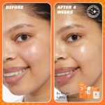 Revolution Skin, Be Bright 4 Step Starter Kit, Brightening Skincare Set Includes Cleanser, Toner, Serum & Moisturiser, Vegan & Cruelty-Free, 4 Products Included - Image 4