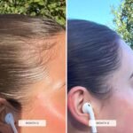 HAIR BURST Vegan Biotin Gummies for Hair Growth, Skin and Nails - Chewable Vitamins with Zinc & Selenium, for Thicker, Shinier Hair (Strawberry Flavour) - 30 Day Supply - Image 7