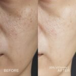 Skin Republic Vitamin C 6% Brightening Face Serum, Helps to reduce Pigmentation and Dark Spots & provides Long Lasting Hydration (30ml) - Image 7