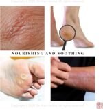 Shiunko Purple Cloud Herbal Balm 25g – Natural Skincare for Eczema, Dry & Itchy Skin, Insect Bites, Minor Burns – Traditional Chinese Remedy – 100% Handmade in UK with Angelica & Gromwell Root - Image 5