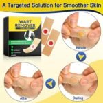 Wart Remover Plasters Patches 30 Pads Maximum Strength Verruca Corn Removal for Plantar Warts on Feet Hands Toes, Fast Acting Effective Pain Relief Gentle Herbal Formula - Image 4