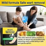 Wart Remover Plasters Patches 30 Pads Maximum Strength Verruca Corn Removal for Plantar Warts on Feet Hands Toes, Fast Acting Effective Pain Relief Gentle Herbal Formula - Image 5