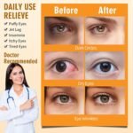Serfeymi Self Heating Steam Eye Mask 22PCS- Disposable Sleep Warming Eye Mask for Puffy, Dry Eyes, Moist Hot Warm Eye Compress, Relief Eyes Fatigue Chamomile - Image 4