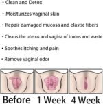 Anniecare Instant Anti-Itch Detox Slimming Products - Instant Itching Stopper & Detox and Slimming & Firming Repair & Pink and Tender Natural Capsules (1 Box) - Image 8