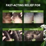 RoyceDerm Tea Tree Scalp Relief Spray: Leave-In Scalp Care for Dry, Flaky, and Itchy Scalp - Tea Tree Oil Formula for Dandruff, Comfort, Hydration, and Balance - Conditioning Support for Women & Men - Image 4