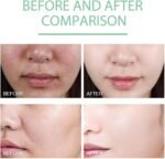 She Eureka Exfoliating Gel,Sheeureka Gel,She Eureka Skin Exfoliating Gel,Herbal Exfoliating Gel,Herbal Extract Exfoliating Gel,Face and Body Exfoliating Gel for All Skin (3pcs) - Image 3