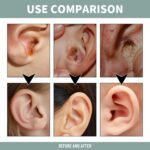 Tinnitus Relief Spray,Tinnitus Relief for Ringing Ears,Fast Acting Tinnitus Relief for Ringing Ears,Ear Pa-in Relief for Adult,Effective Herbal Drops,Ear Calm Spray,Ear Drops for Itchy Ears - Image 3