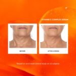 Naturium Vitamin C Complex Face Serum with Hyaluronic Acid & Vitamin E - Mini - Image 5