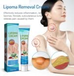 LumpFree Lipoma Removal Cream, Magical Lipoma Elimination Cream Ointment Made from Natural Herbal Extracts Treats, Lipoma Removal Ointment (1Pcs) - Image 3