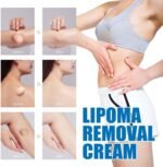 LumpFree Lipoma Removal Cream, Magical Lipoma Elimination Cream Ointment Made from Natural Herbal Extracts Treats, Lipoma Removal Ointment (1Pcs) - Image 5