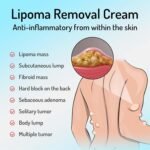 LumpFree Lipoma Removal Cream, Magical Lipoma Elimination Cream Ointment Made from Natural Herbal Extracts Treats, Lipoma Removal Ointment (1Pcs) - Image 6