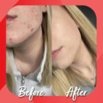 Kollo Premium Marine Collagen Liquid, 10,000 mg - Essential Proteins Collagen Peptides - Liquid Collagen Supplements for Women & Men with Vitamins B & C - Informed Sport Certified - Pack of 28 - Image 5