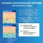 Reverse Life - Lifting Eye Cream for Wrinkles - Eye Cream for Dark Circles and Puffy Eyes with Lifting and Filling Properties - Hyaluronic Acid, Coconut Extract & Vitamin C - 30ml - Image 4